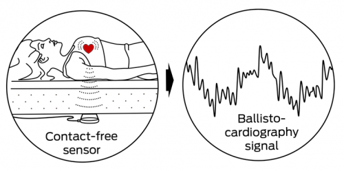 Ballistocardiography-image1-oai9rutsuxmp4v03eswz50ll17cc4c0l9poda2z1yy